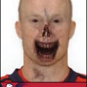 zombie_chimera