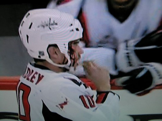 matt bradley bleeding