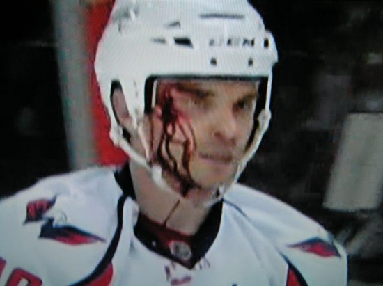 matt bradley bleeding